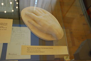 メンデルスゾーンの手の石膏
